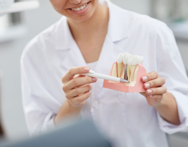 dentist-explaining-tooth-implantation-process-W4PZYA8.jpg